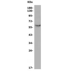 Western blot testing of human HepG2 cell lysate with SLC2A10 antibody. Expected molecular weight: 57
