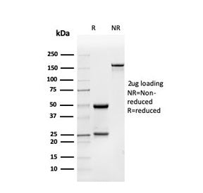 BMP15 Antibody / Bone morphogenetic protein 15
