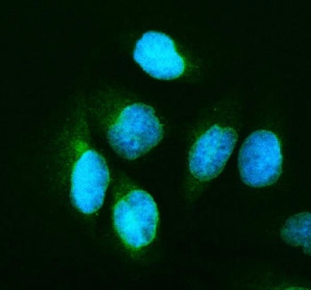 Immunofluorescent staining of FFPE human U-2 OS cells with p65 antibody (green) and DAPI nuclear sta