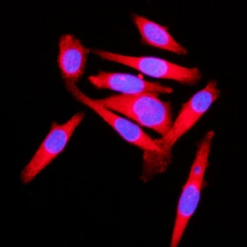 KLC1 Antibody / Kinesin light chain 1
