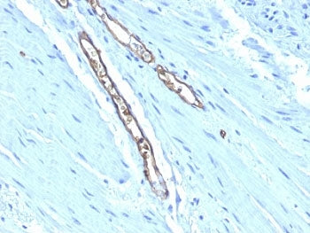 ABO Antibody (Blood Group Antigen A)