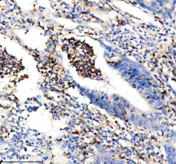 Immunohistochemical staining of Granzyme M/GZMM using anti-GZMM antibody. Granzyme M/GZMM was detect