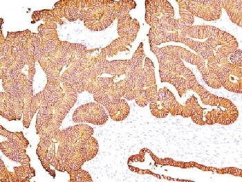 EpCAM Antibody