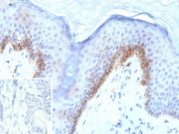 IHC staining of FFPE human dkin tissue with PSAP antibody (clone KLK4/8943). Inset: PBS used in plac