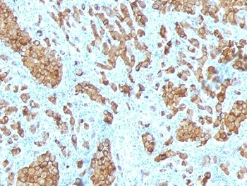 MART-1 / Melan-A Antibody