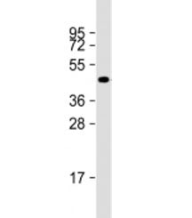 Western blot testing of human A549 cell lysate with NAT16 antibody at 1:2000. Predicted molecular we