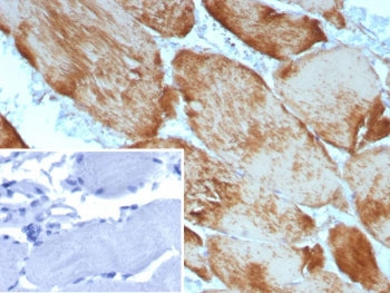 IHC staining of FFPE human skeletal muscle tissue with recombinant Alpha Actin 1 (ACTA1/9105R). Inse