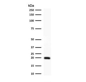 Western blot testing of human HeLa cell lysate with Ferritin antibody (clone FTLC1-1). Predicted mol
