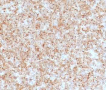 IHC staining of FFPE human spleen with CD137 antibody (clone CDLA137-1). HIER: boil tissue sections 