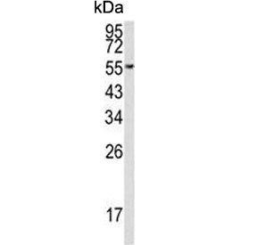Western blot testing of human MCF7 cell lysate with EEF1A1/2 antibody. Predicted molecular weight ~5