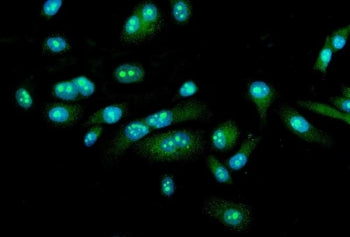 Immunofluorescent staining of FFPE human PC-3 cells with FEZF1 antibody (green) and DAPI nuclear sta