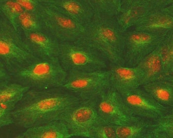 Immunofluorescent staining of FFPE human A549 cells with ALKBH5 antibody (orange) and Alpha Tubulin 