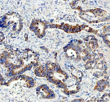 AMACR / p504S Antibody (Prostate Cancer Marker)
