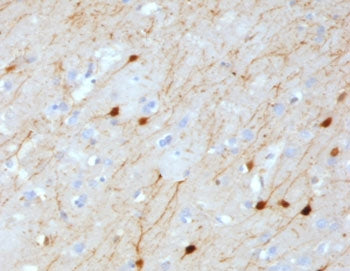IHC testing of FFPE human cerebellum with Calretinin antibody (clone CLRT-1). HIER: boil tissue sect