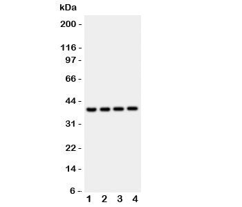 Western blot testing of Cathepsin D antibody and mouse samples: 1: liver; 2: brain; 3: thymus; 4: Ne