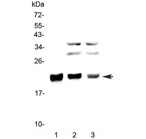 Western blot testing of 1) human SW620, 2) rat thymus and 3) mouse thymus lysate with CBFB antibody 