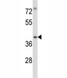 Irak4 antibody western blot analysis in MDA-MB435 lysate. Predicted molecular weight 52/37 kDa (isof