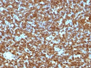 CD45RA Antibody (Leukocyte marker)