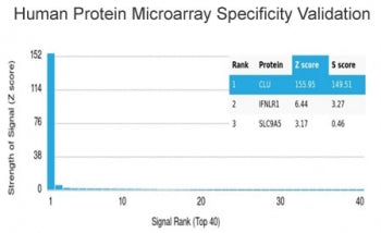 Analysis of HuProt(TM) microarray containing more than 19,000 full-length human proteins using Clust
