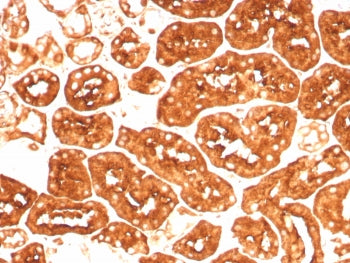 IHC staining of FFPE human kidney tissue with recombinant Ferritin Heavy Chain antibody (clone FTH/8