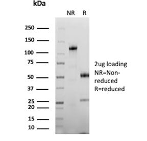 SDS-PAGE analysis of purified, BSA-free CEA antibody (clone C66/1292) as confirmation of integrity a