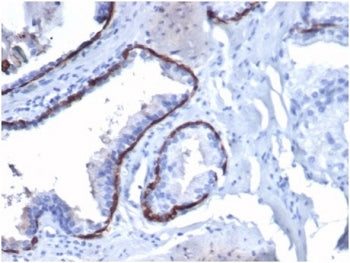 CK14 Antibody / Cytokeratin 14 / KRT14