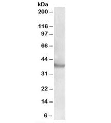 Western blot testing of human skeletal muscle lysate with Rapsyn antibody at 0.5ug/ml. Predicted mol