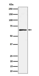 Western blot analysis of RIPK2 in human K562 cell lysate using RIPK2 antibody. Expected molecular we
