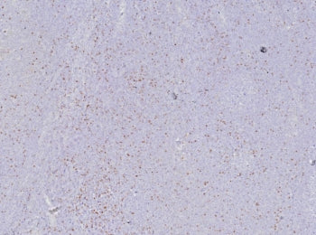 IHC staining of FFPE human tonsil tissue with FOXP3 antibody (clone FOXP3/8277R). HIER: boil tissue 