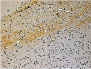 IHC testing of FFPE mouse brain with JIP3 antibody at 4ug/ml. HIER: steamed with pH6 citrate buffer,