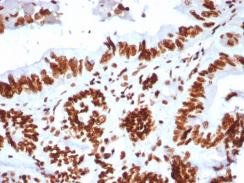 BRG1 Antibody / SMARCA4