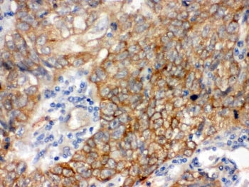 BAG3 Antibody
