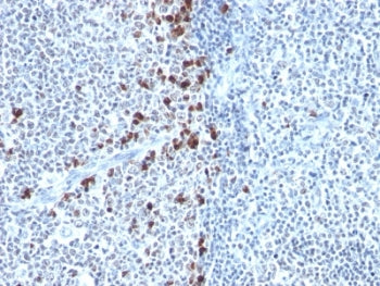 IHC: Formalin-fixed, paraffin-embedded human tonsil stained with Kappa Light Chain antibody (clone H