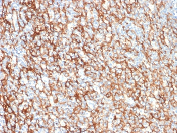 IHC staining of FFPE human tonsil tissue with CD73 antibody (clone NT5E/2505). HIER: boil tissue sec