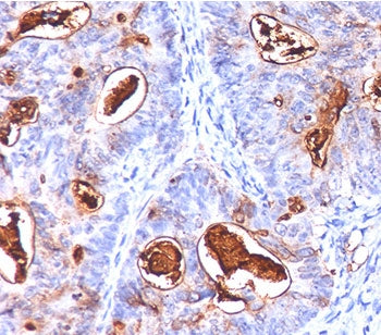 CEA Antibody Cocktail