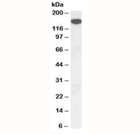 Western blot testing of mouse kidney lysate with Thrombospondin antibody at 1ug/ml. Expected molecul