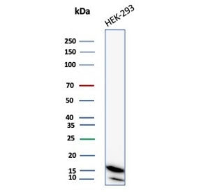 NME2 Antibody / Nucleoside diphosphate kinase B / NDKB