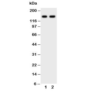 Western blot testing of anti-CD45 antibody and Lane 1: Jurkat; 2: CEM; Expected molecular weight: ~1