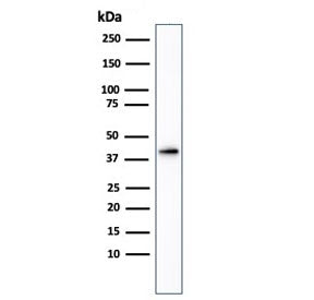 AMACR / p504S Antibody (Prostate Cancer Marker)