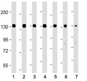 Western blot testing of Myosin Phosphatase antibody at 1:4000: Lane 1) human HEK293, 2) (h) HeLa, 3)