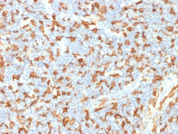 IHC testing of FFPE human lymph node with IBA1 antibody (clone AIF1/1909). HIER: boil tissue section