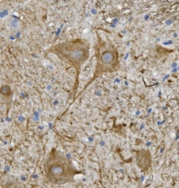 IHC staining of FFPE mouse spinal cord with Neurofilament Light antibody. HIER: boil tissue sections