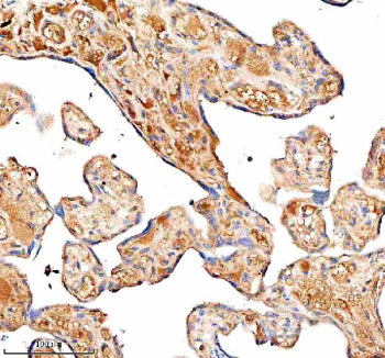 Immunohistochemical staining of SERPING1/C1 using anti-C1 Inhibitor (C1-INH) antibody. SERPING1/C1 w