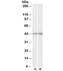 Western blot testing of human [A] and mouse [B] kidney lysates with Podocin antibody at 0.3ug/ml. Pr