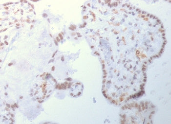 IHC testing of FFPE human placenta with Dnmt3a antibody. Required HIER: boil sections in 1mM EDTA, p