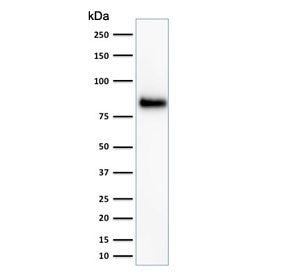 Western blot testing of HeLa cell lysate with HCAM antibody (clone HCAM/918). Predicted molecular we