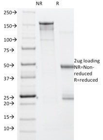 SDS-PAGE analysis of purified, BSA-free BRAF V600E antibody (clone V600E/1322) as confirmation of in