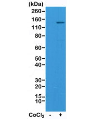 Western blot test of Jurkat cell lysate, untreated or treated with Cobalt Chloride (CoCl2), using re
