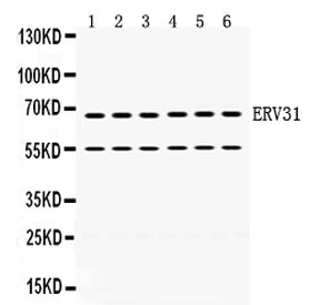 Western blot testing of human 1) HeLa, 2) 22RV1, 3) HepG2, 4) SKOV, 5) A431 and 6) HT1080 cell lysat