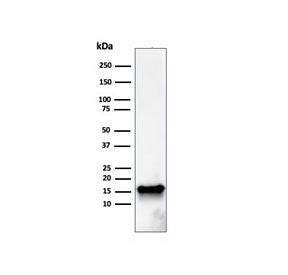 Western blot testing of human HeLa cell lysate with FABP5 antibody. Predicted molecular weight ~15 k